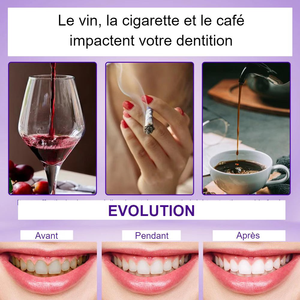 Sérum Blanchissant ModerneSmile™ V34 - éclat instantané pour un sourire radieux