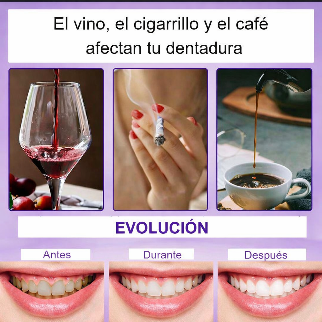 Suero blanqueador ModerneSmile™ V34: resplandor instantáneo para una sonrisa radiante